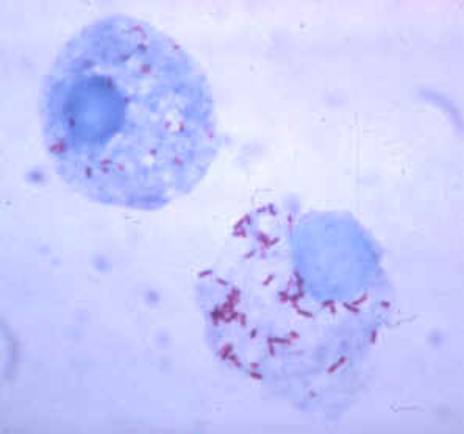 cells infected with R. rickettsii